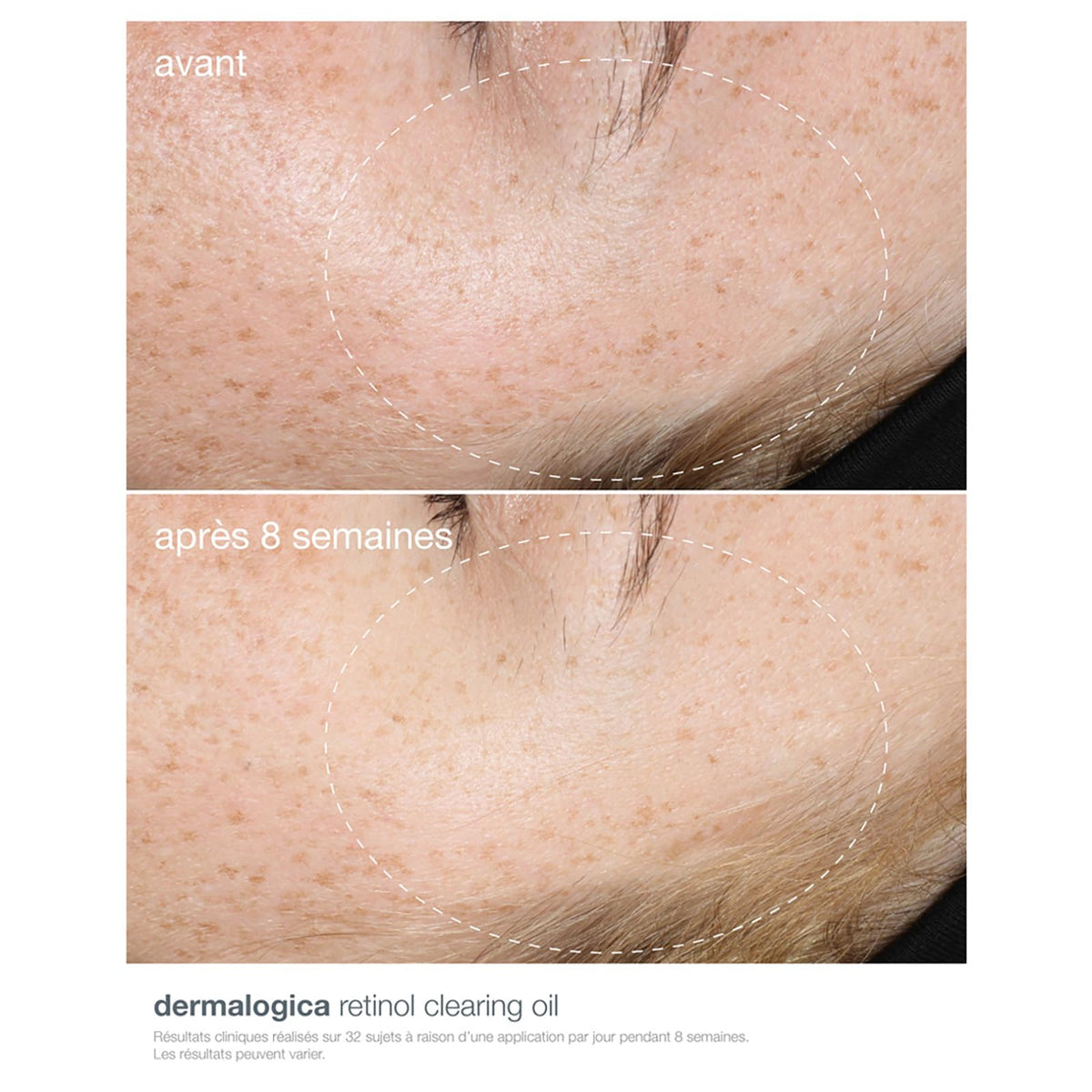 Dermalogica Retinol Clearing Oil 30ml/1oz