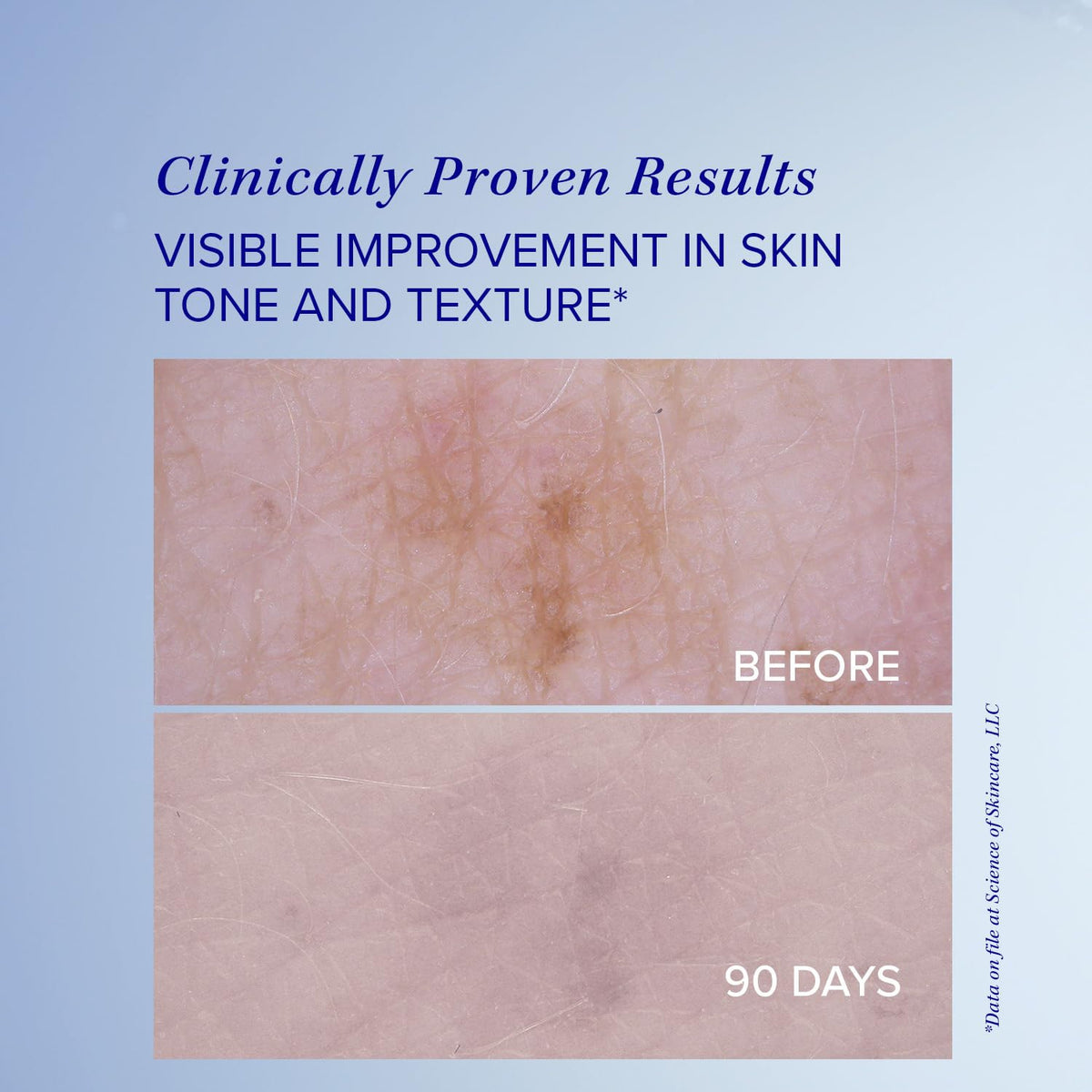 Is Clinical White Lightening Serum 30ml/1oz