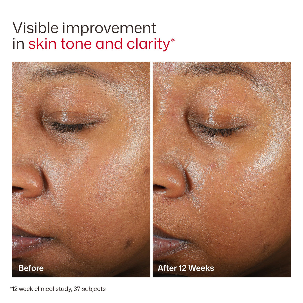 EltaMD UV Clear SPF 46 Tinted Face Sunscreen 48g/1.7oz