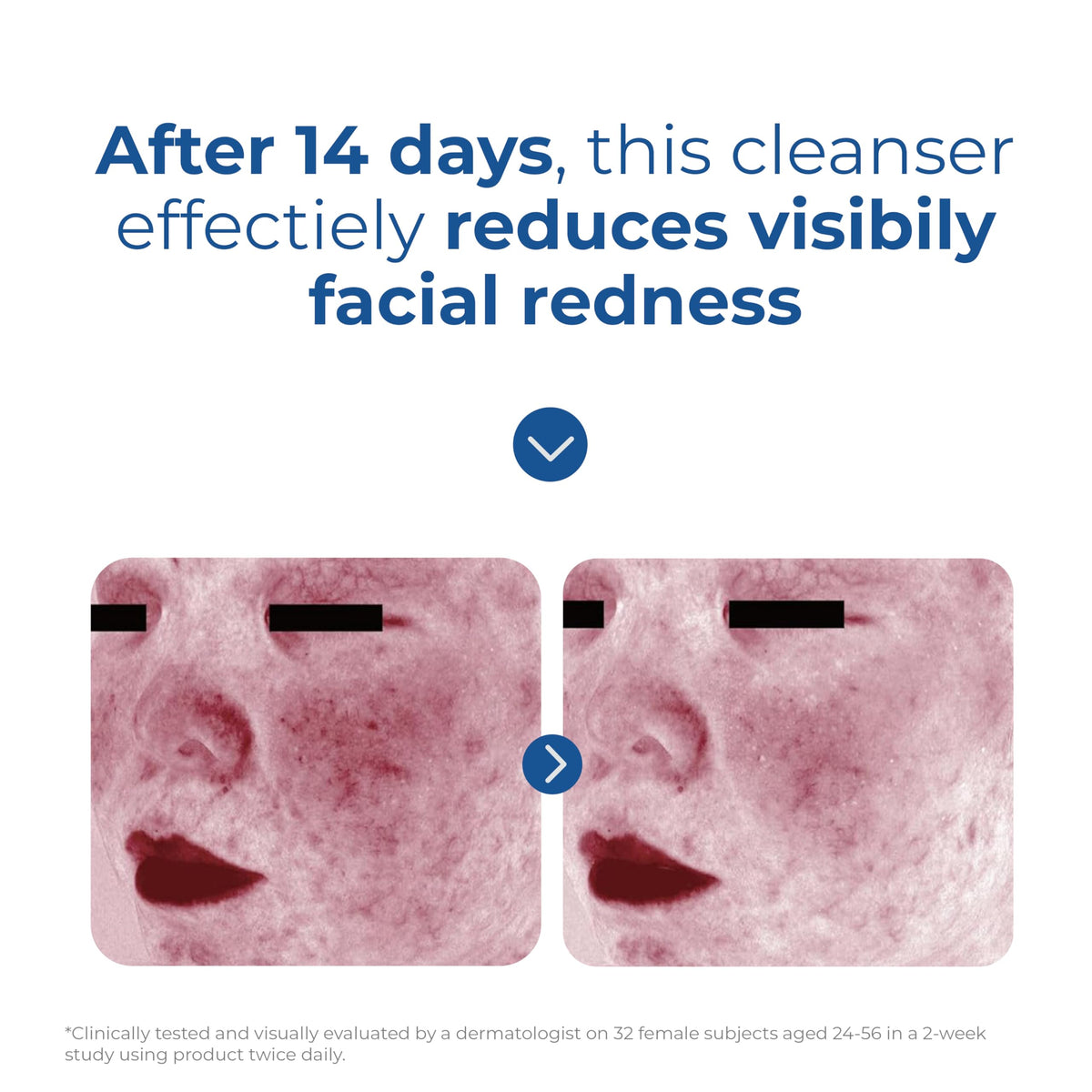 EltaMD Skin Recovery Amino Acid Foaming Cleanser 150ml/5oz